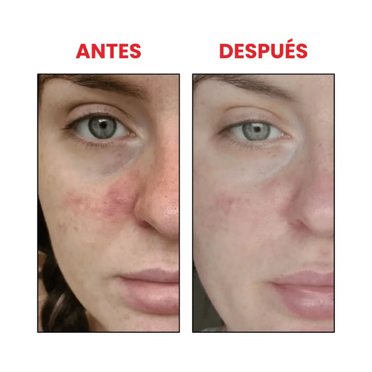 THE ORDINARY Azelaic Acid Suspension 10%