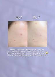 APLB Glutathione Niacinamide Mist Essence Toner 105ml