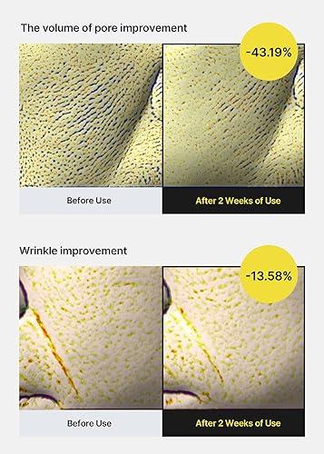 CELIMAX Retinal Shot