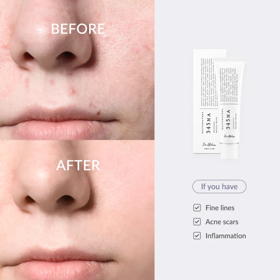 DR. ALTHEA 345 Relief Cream