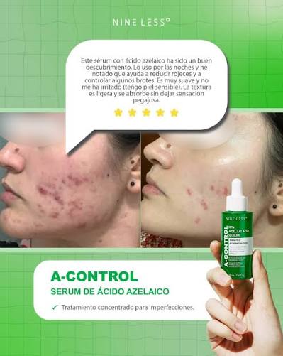 NINELESS A-Control 10% Azelaic Acid Serum