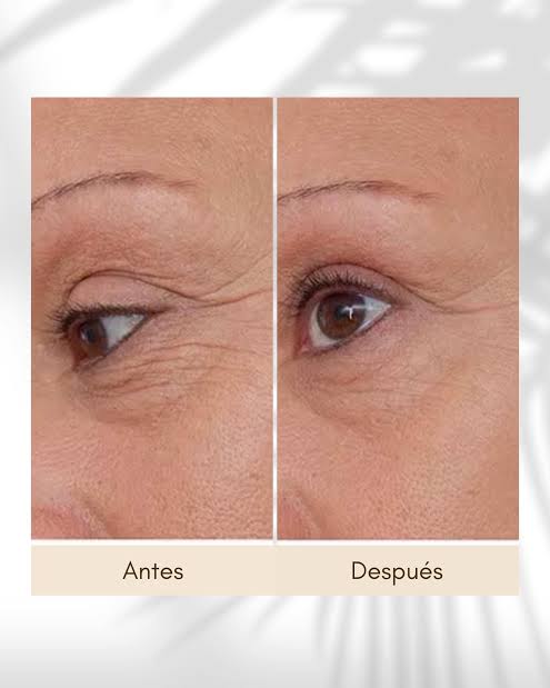 THE ORDINARY Argireline Solution 10%