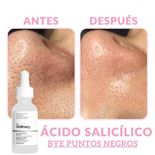 THE ORDINARY Salicylic Acid 2% Solution