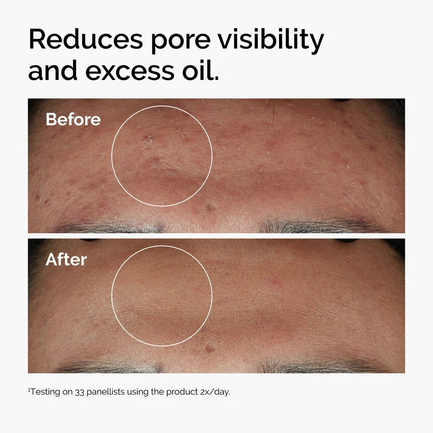 THE ORDINARY Niacinamide 10% + Zinc 1%
