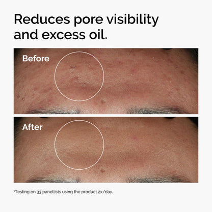 THE ORDINARY Niacinamide 10% + Zinc 1%