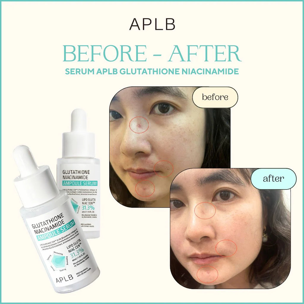 APLB Glutathione Niacinamide Ampoule Serum