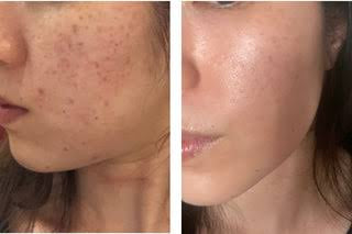 SKIN1004 Madagascar Centella Tone Brightening Capsule Ampoule