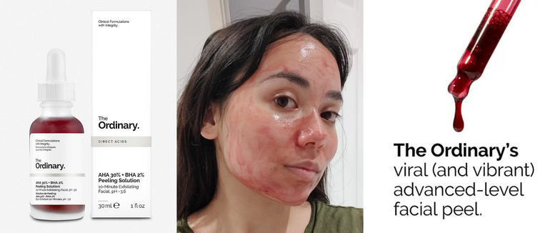 THE ORDINARY AHA 30% + BHA 2% Peeling Solution