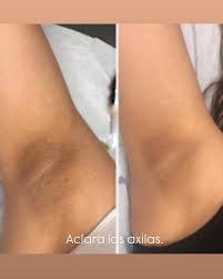 THE ORDINARY Glycolic Acid 7% Toning Solution