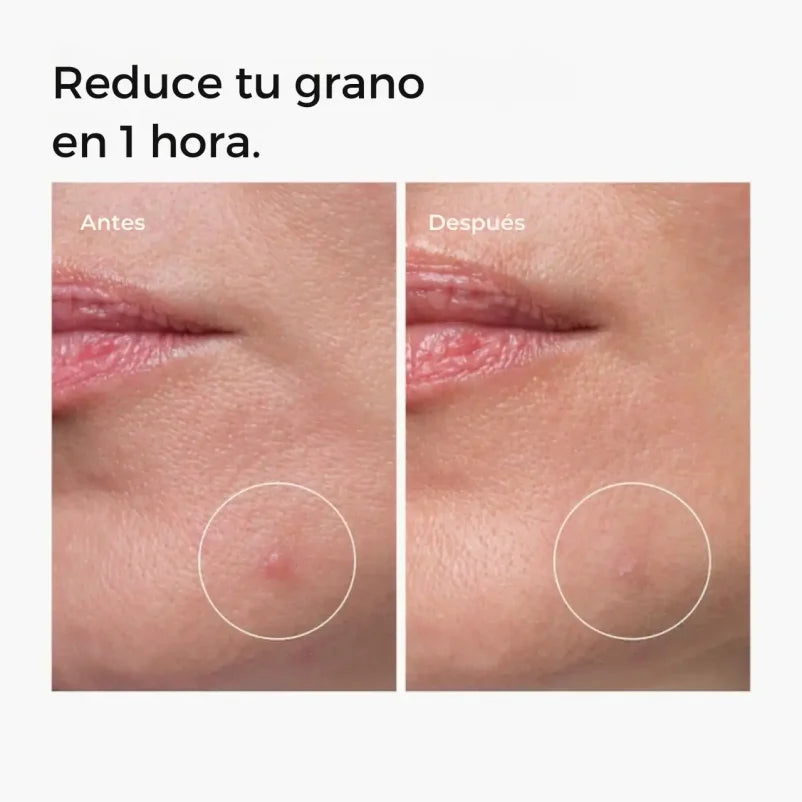 THE ORDINARY Sulfur 10% Powder-to-Cream Concentrate 5ml